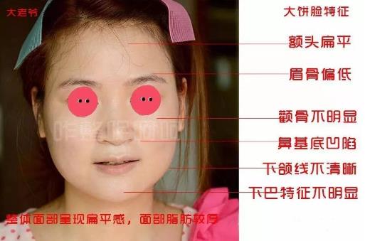 大饼脸是什么意思?一个人脸大的原因 大饼脸的瘦脸方法