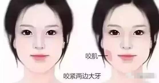大饼脸是什么意思?一个人脸大的原因 大饼脸的瘦脸方法