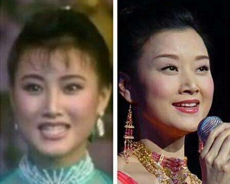 岁月是把杀猪刀也常常用在演艺明星身上