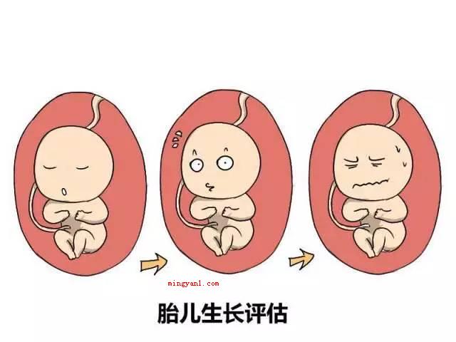 sd是什么意思