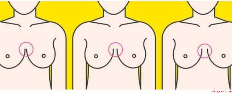 外八胸型是什么样子（外八胸型也叫木瓜型,乳房突出的长度大于乳房基部的圆周半径）