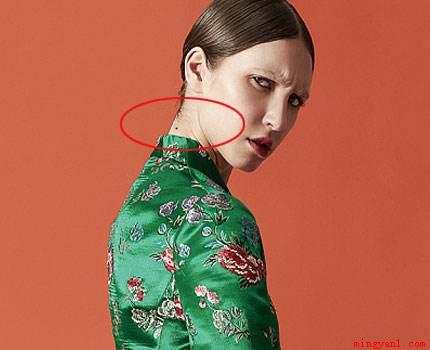 脖子上有痣代表什么（脖子上有痣的几种说法,这些是命相学上）