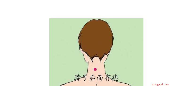 脖子上有痣代表什么（脖子上有痣的几种说法,这些是命相学上）
