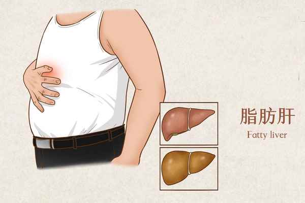 摄图网_401804062_banner_脂肪肝医疗插画(企业商用).jpg 脂肪肝吃什么好