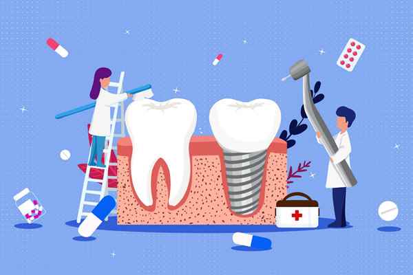 种植牙2.jpg 种植牙的好处与坏处