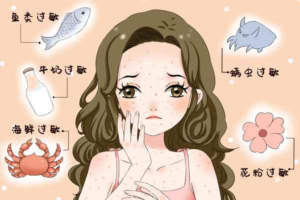 摄图网_401765469_banner_皮肤过敏(企业商用).jpg 海鲜过敏症状