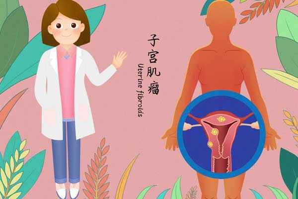 子宫肌瘤医疗插画.jpg 子宫肌瘤是什么病