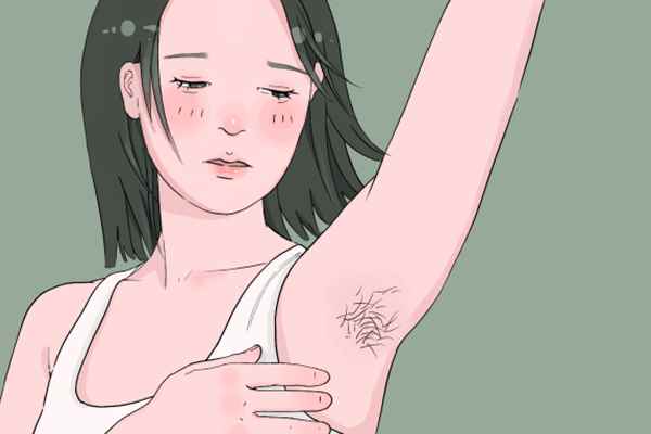 做冰点激光脱毛痛不痛