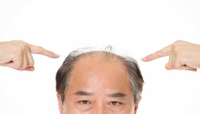 梦见拔白头发