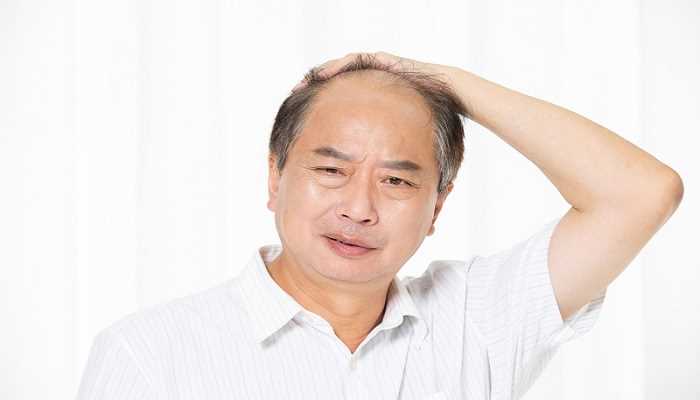 梦见自己秃顶