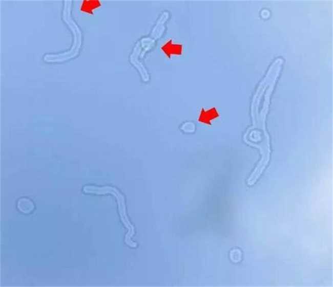 关注视觉健康(视觉健康远离飞蚊症该怎么做)
