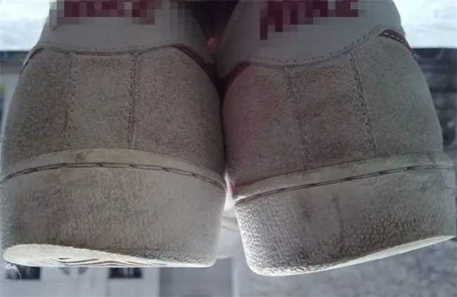 鞋子磨损能看出身体情况吗(鞋子的磨损程度可以看出身体健康)