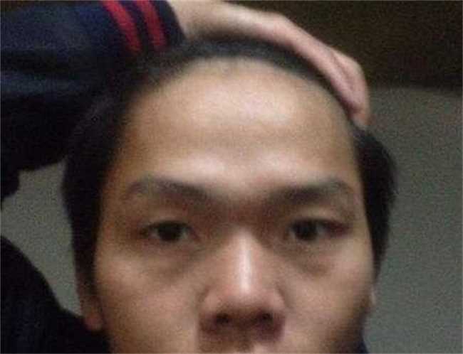 额头有两个凸起的人面相怎么样(额头上有两个凸起面相好吗)