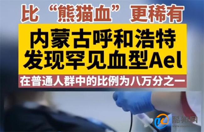 呼和浩特发现比熊猫血更稀有血型Ael Ael血型很稀有吗_酷知科普