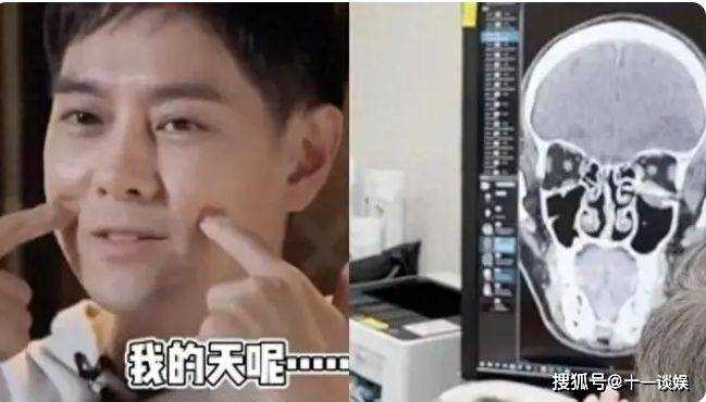 林志颖称车祸后理解能力变差 坚韧不拔的战胜车祸阴影