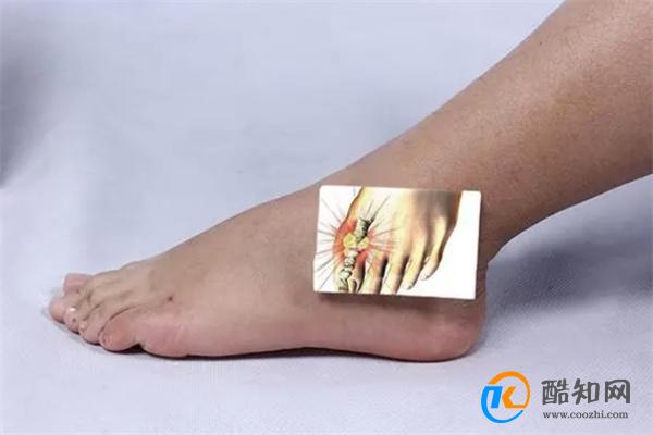 “三高”外的第四高,高尿酸怎么形成的?高尿酸血症等于痛风吗?