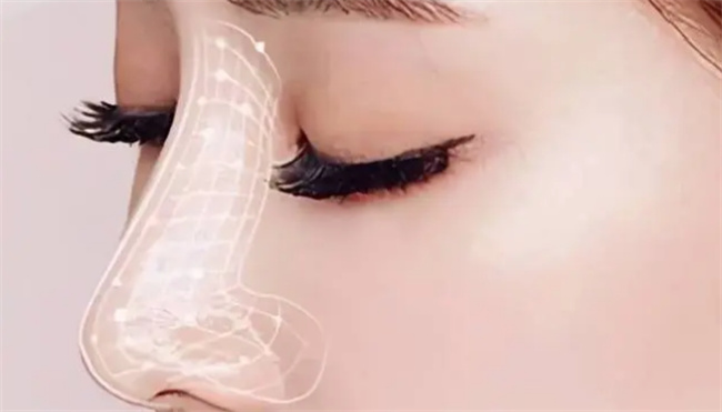硅胶隆鼻有什么副作用吗 硅胶隆鼻安全吗