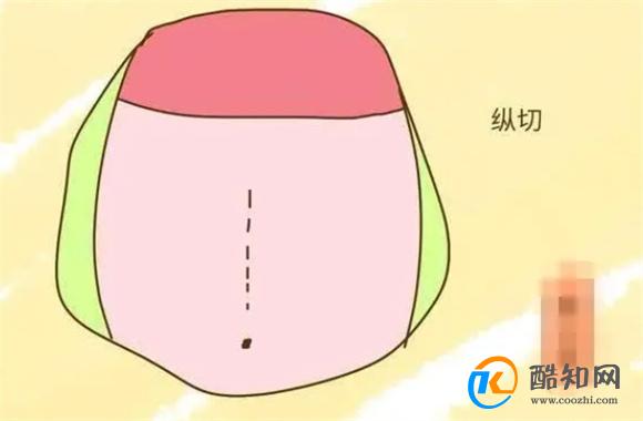 越来越多的孕妇喜欢剖腹产,原来是这几个原因,你能猜到几个?