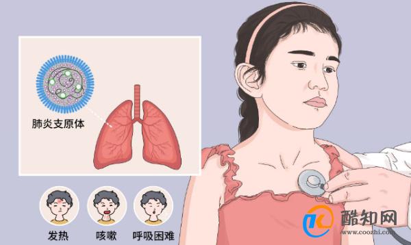 支原体肺炎主要症状是有2个_酷知科普