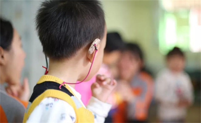 上海人工耳蜗纳入医保可减约七成费用 有哪些影响