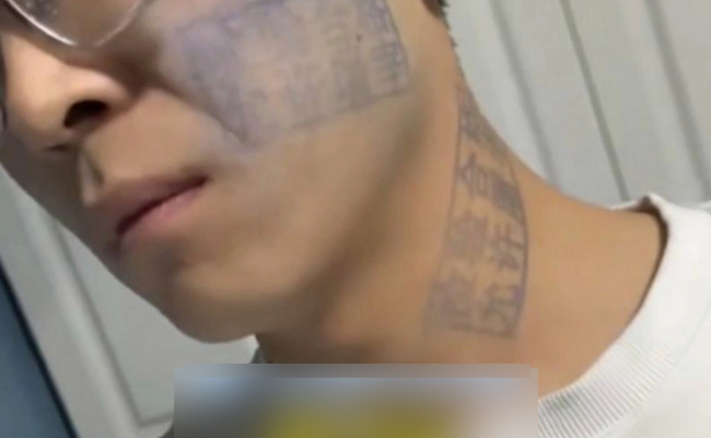男子玩游戏被盖猪肉印章去除不了 也如何清理呢