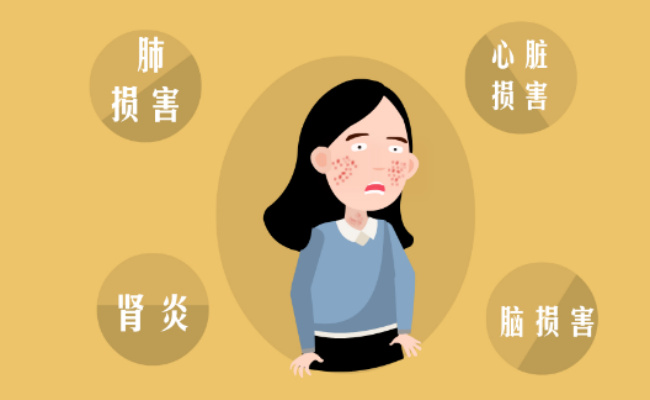 红斑狼疮是什么病