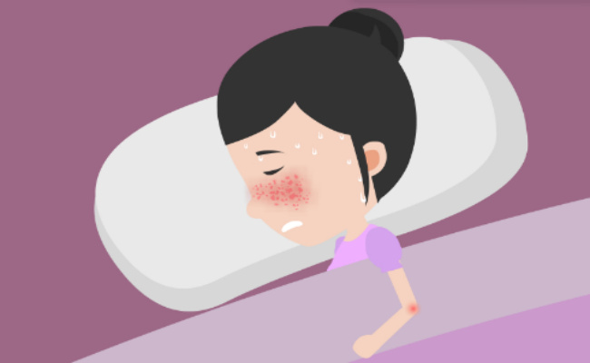 红斑狼疮是什么病