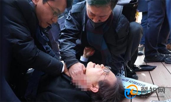 韩国最大在野党党首李在明遇袭 李在明现在状况怎样