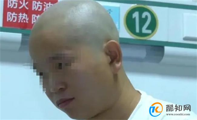姐弟烧伤四位姨妈剃光头捐头皮 头皮捐献后注意事项