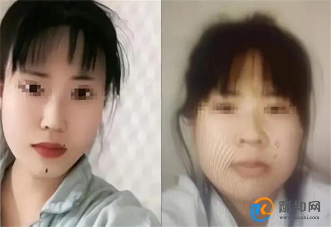 女孩花21万整形出院当天跳河自杀 整形失败如何维权