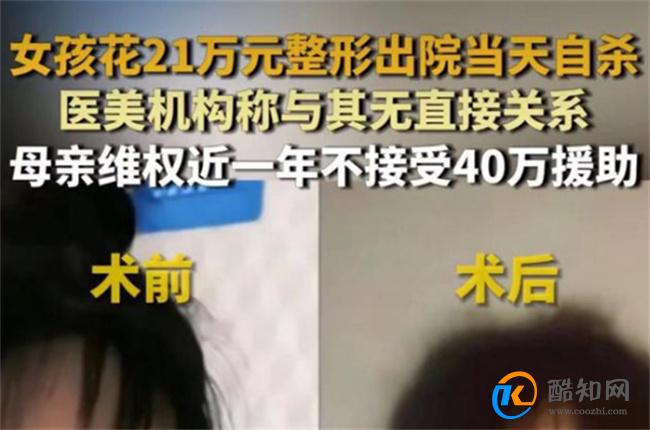 女孩花21万整形出院当天跳河自杀 整形失败如何维权