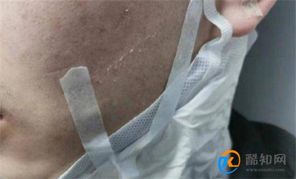 高中生疑遭同学群殴被逼喝尿 校园霸凌的影响