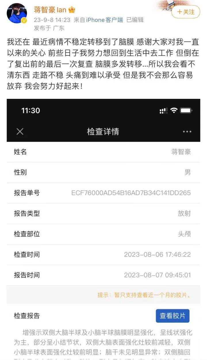 28岁男星回应确诊肺癌晚期:癌细胞已多发转移 健康现状仍不稳定