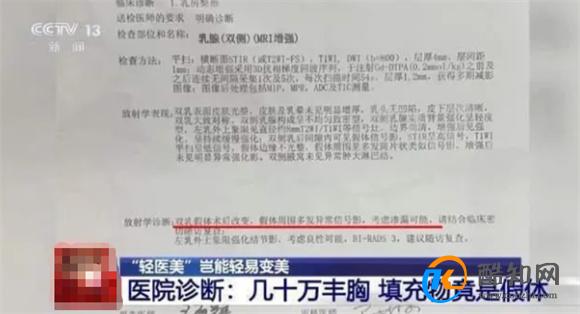 女子丰胸检出骆驼等动物源性成分 丰胸的危害