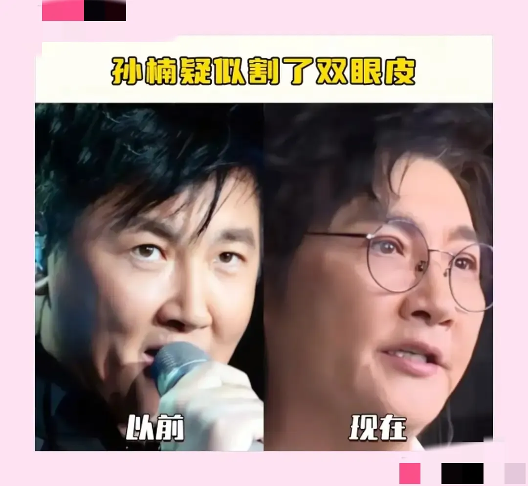 孙楠撞脸陈萍萍 一把年纪还搞了欧式大双眼皮引网友调侃