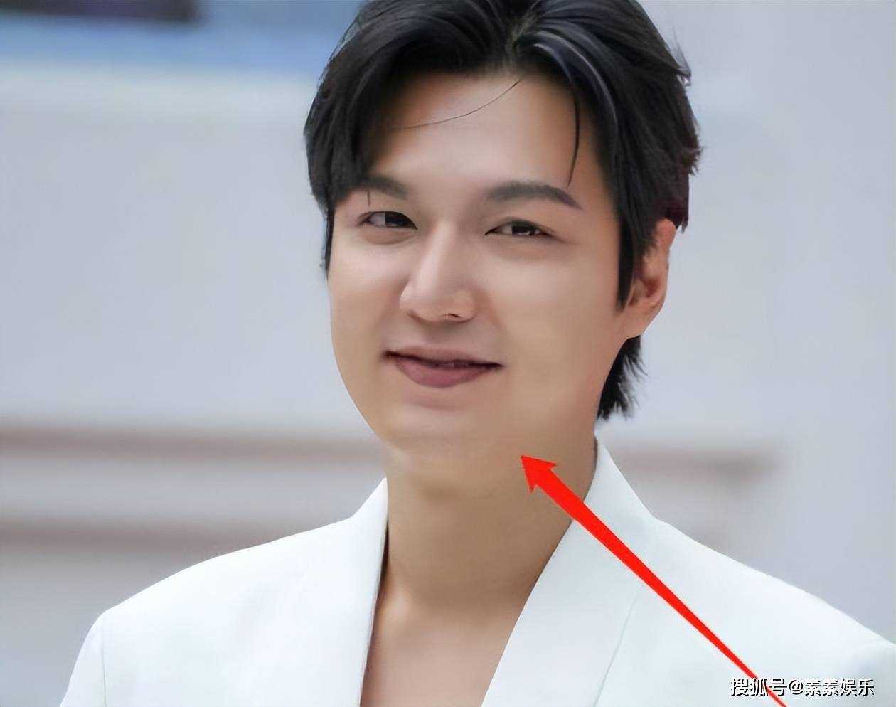 37岁李敏镐发福变双下巴